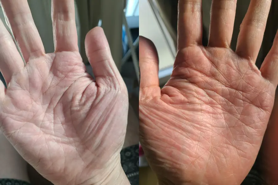 メチャクチャな手相