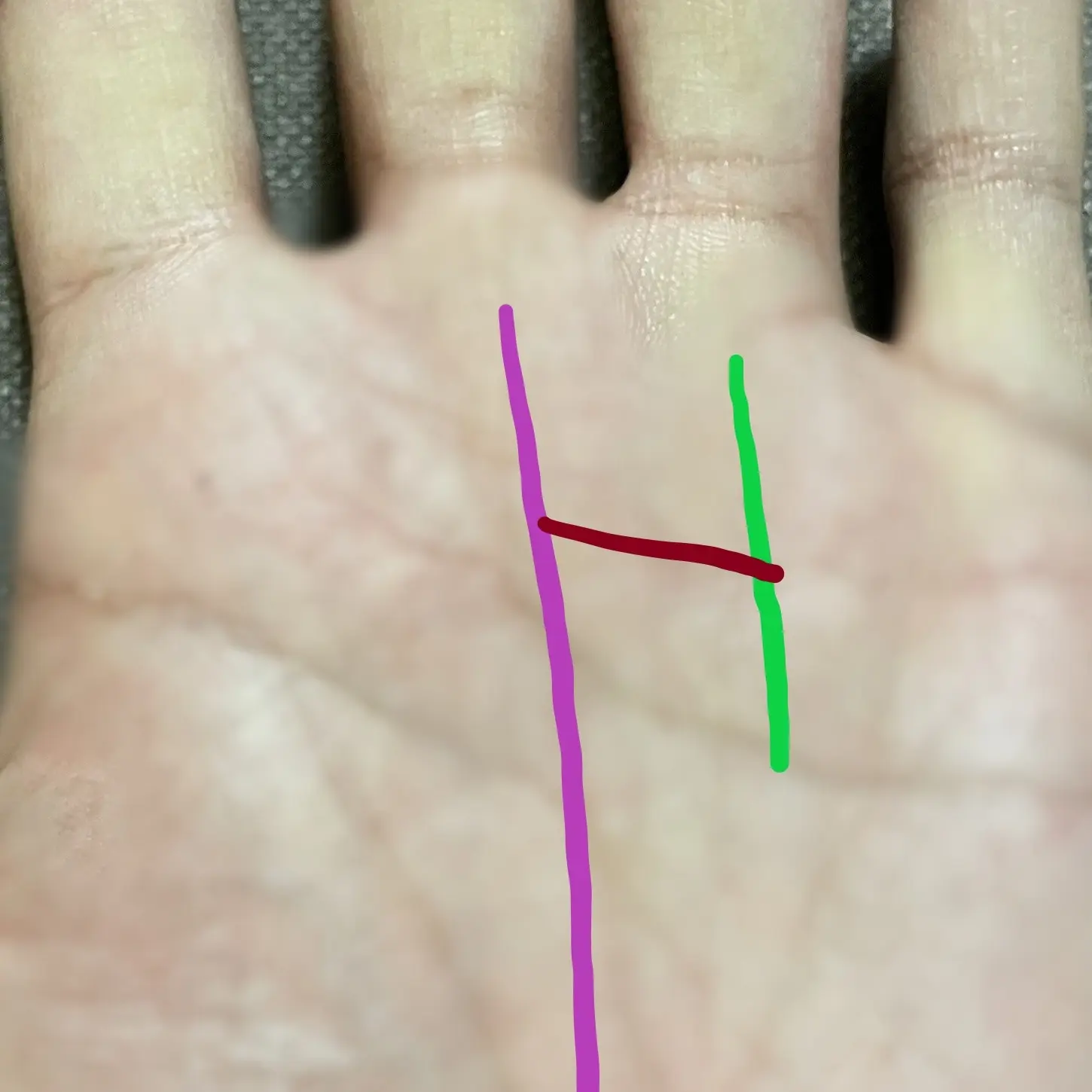 不動産線、はしご型