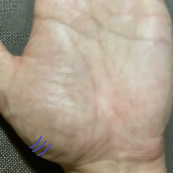 カリスマ線（陰徳線）