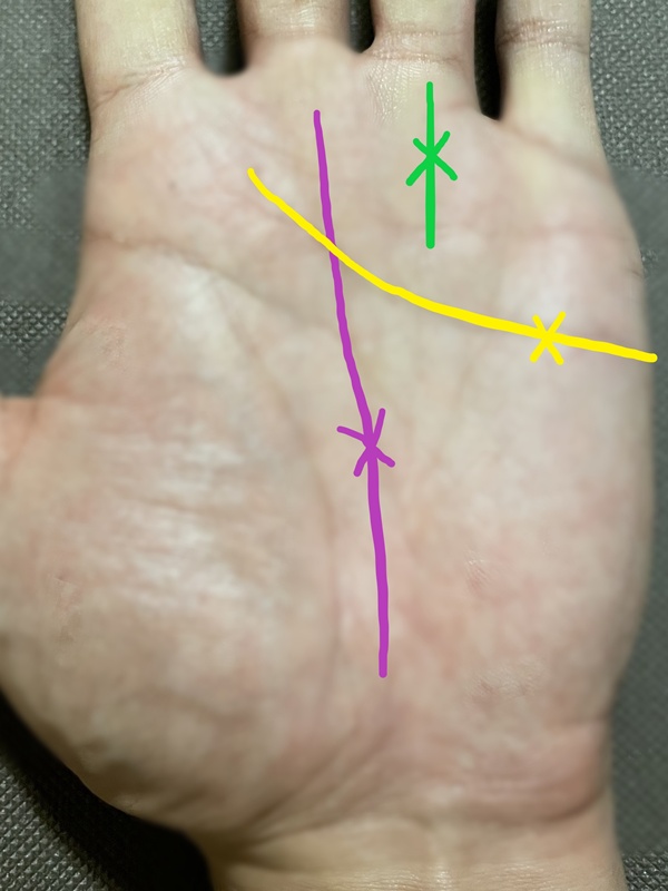 運命線や感情線、太陽線に出るスター