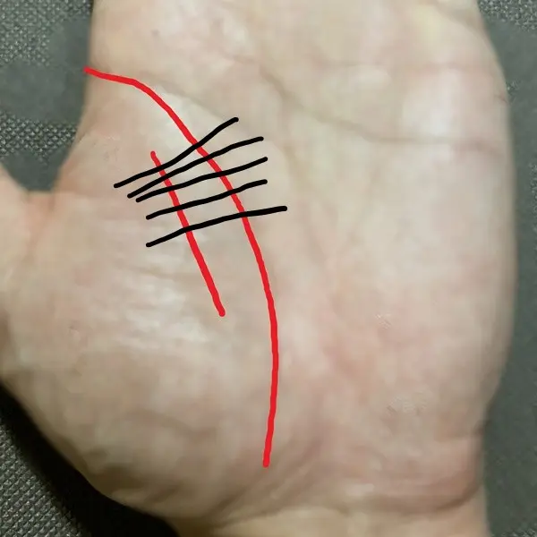 二重生命線に横切る障害線